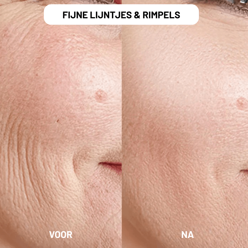 NAD+ Restore voor Vrouwen
