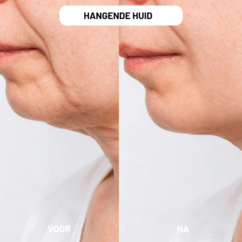 NAD+ Restore voor Vrouwen